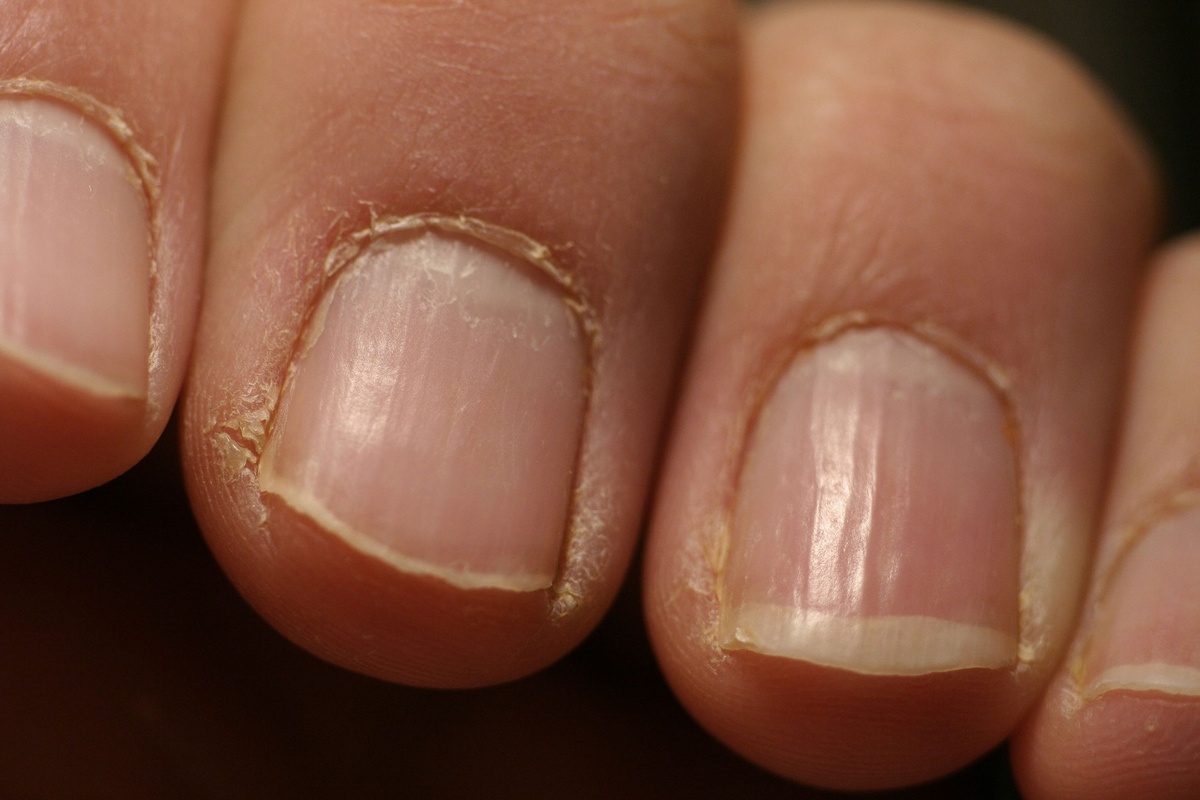 nagelriempjes
